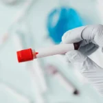 Скільки наркотики тримаються в організмі: у крові, сечі та волоссі